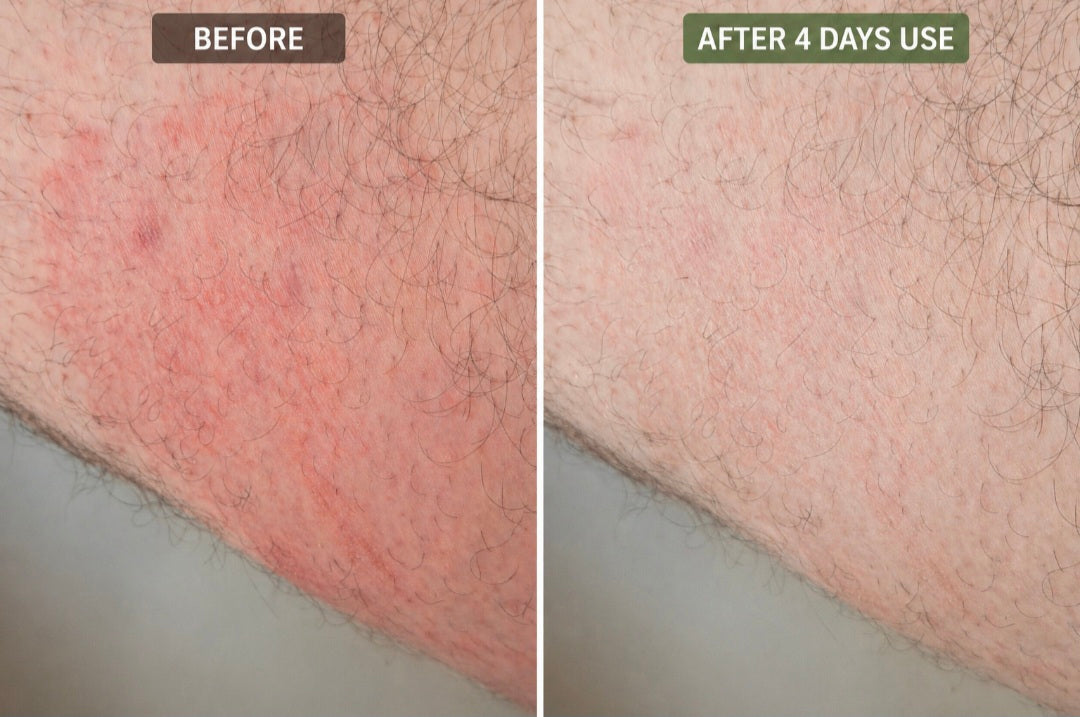 Botanical Skin Balm